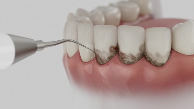 Trusted Teeth Cleaning And Checkup service in Midlothian, VA - Dentist Open Now